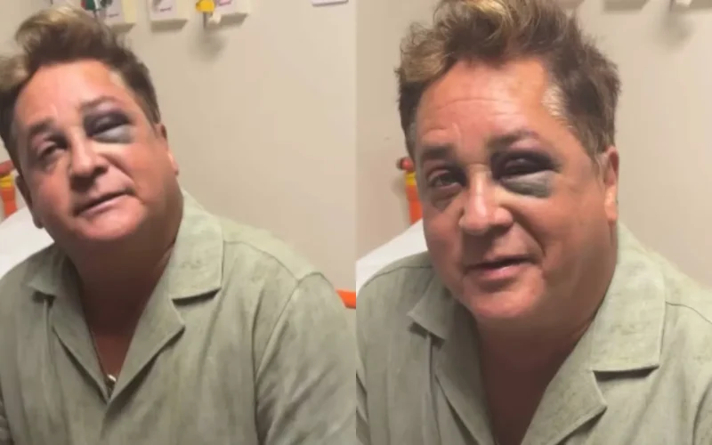 Leonardo aparece com olho roxo após queda e vai parar no hospital; entenda